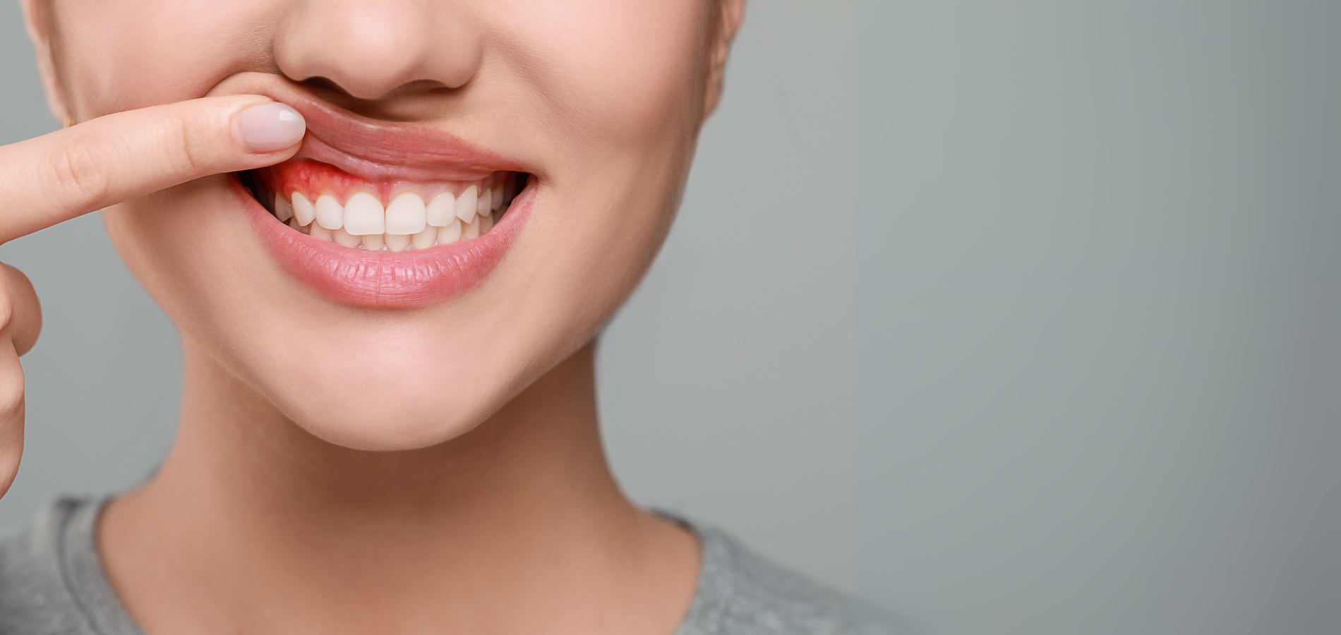 Invisalign Hero