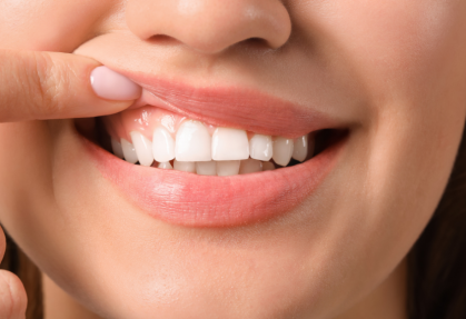 Is Gum Disease Contagious? And the 10-Second Gum Check You Can Do at Home